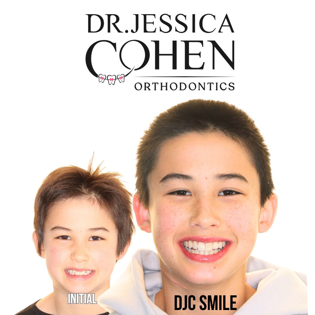 Young man with teeth smiling